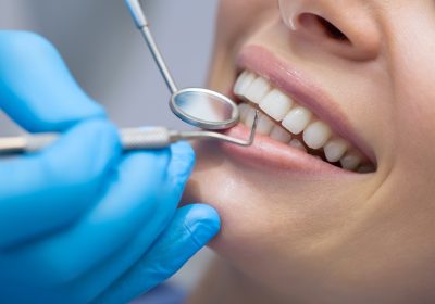 Restorative Dentistry 101: Explaining the Common Procedures