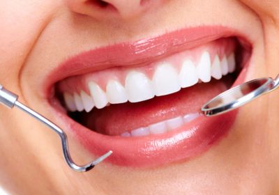 Dental Procedures in Burlington, ON, to Improve Your Smile 