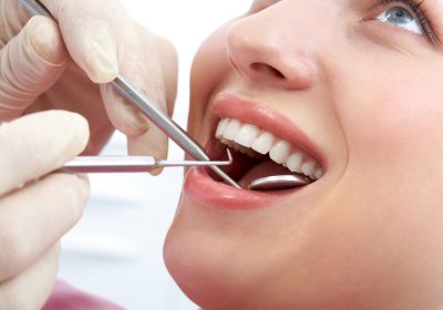 What are the Common Types of Dental Restorations in Palm Harbor?