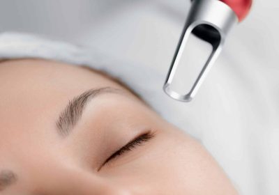 What You Should Know About Picosure Laser Treatments