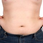 The Impact of CoolSculpting on Skin Tightening