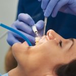 Most Common Dental Procedures and How They Work