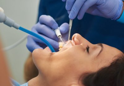 Most Common Dental Procedures and How They Work