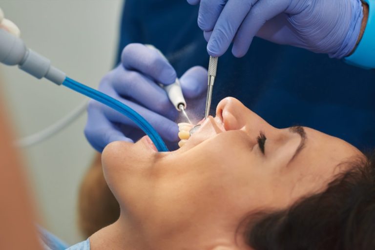 Dental Procedures