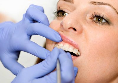 From First Dental Bracket to Final Smile – Every Phase Explained